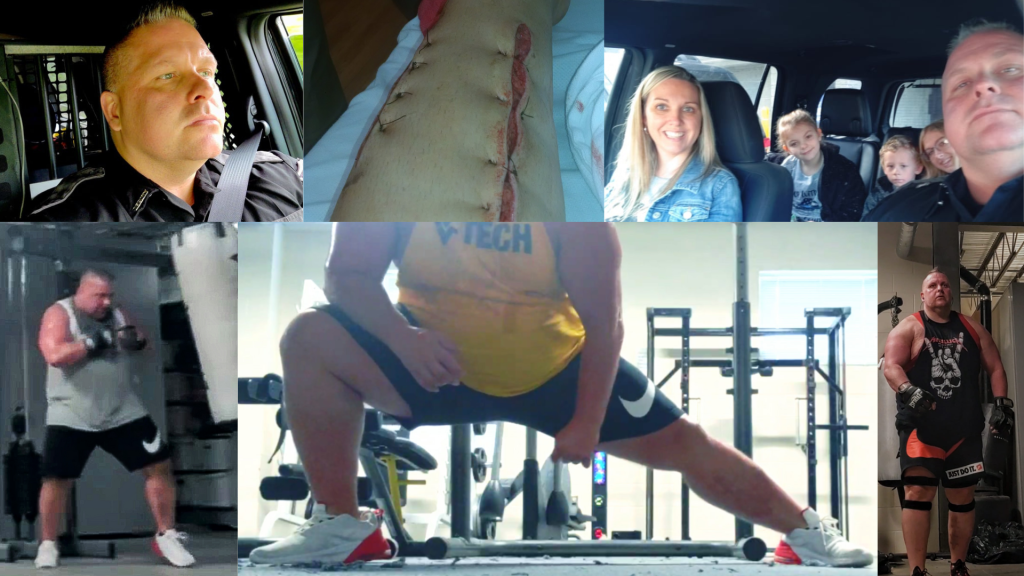 Defying the Odds: How a Sheriff Deputy Saved His Leg Through Weightlifting and Walking