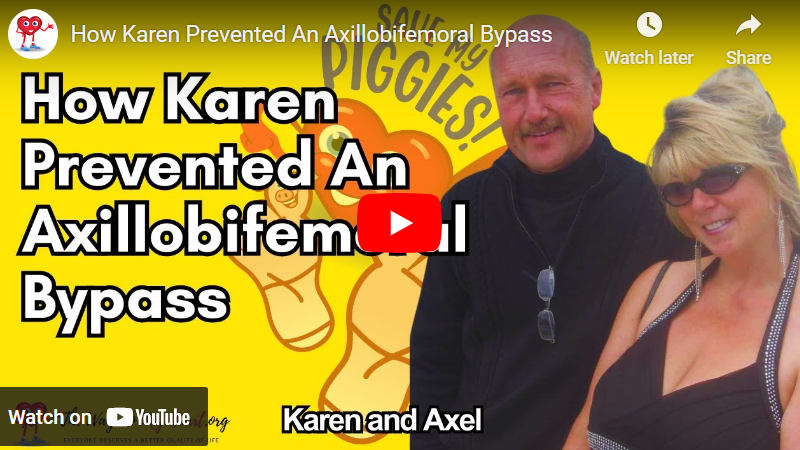 Karen Said, “NO” To An Axillobifemoral Bypass and Wires and Balloons Opened Her Arteries