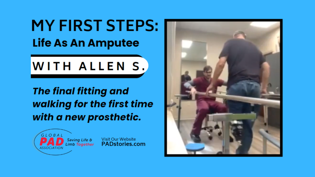 Witnessing Allen’s First Steps As An Amputee